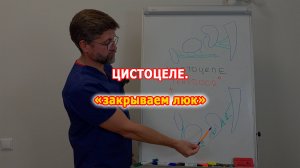 Цистоцеле и TrapDoor. Советы молодым хирургам.