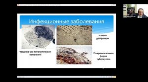 Юнчис О.Н.  «Болезни дискусов (Symphysodon)»