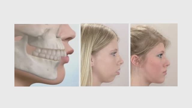 Куда пропадает четкий овал лица 🤯 Разбор проблем и решение + простой ТЕСТ