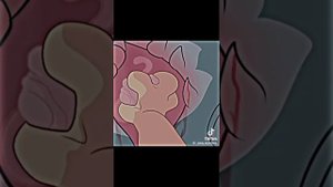 ой третий раз подряд пытаюсь загрузить норм видео 🙄😒