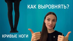 КАК СКРЫТЬ КРИВЫЕ НОГИ | как выровнять ноги | варус и вальгус | накладки на ноги