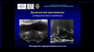 24 Лучевая диагностика заболеваний мочеполовой системы