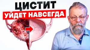 Цистит уйдет навсегда