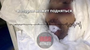 Убитый в Турции сепаратист Абакаров мог работать на спецслужбы Украины