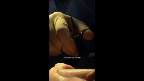Базальная имплантация за две недели │ отзыв Roott