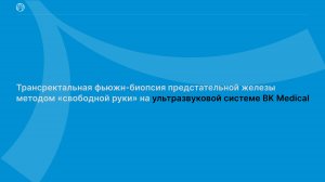 Трансректальная фьюжн-биопсия предстательной железы методом «свободной руки» на ультразвуковой си