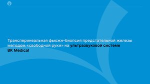 2.Трансперинеальная фьюжн-биопсия предстательной железы методом «свободной руки» на ультразвуковой