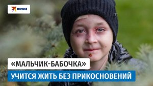 ЖИЗНЬ БОЛЬЮ: шокирующая история мальчика-бабочки из Дагестана