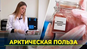 Тюменские учёные разработали «умную» добавку для здоровья кишечника