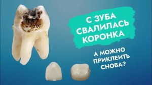 Зубная коронка свалилась. Кто виноват? Что делать?