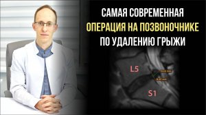 Эндоскопическое удаление грыжи межпозвонкового диска L5-S1 показания, суть операции, риски, реабилит