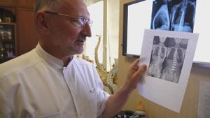 Вертебрологическая школа ЦИТО