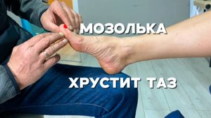 Мозолька на стопе и хрустит таз из-за обуви без фиксации