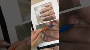 Химический ожог ногтевой пластины