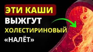 Мало кто знает, АТЕРОСКЛЕРОЗ Боится Эти КАШИ КАК ОГНЯ! Чистят сосуды за 7 дней
