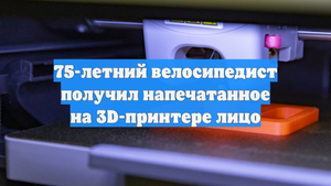75-летний велосипедист получил напечатанное на 3D-принтере лицо
