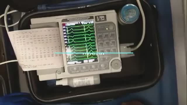 Регистрация экг по Нэбу / Небу смотреть онлайн