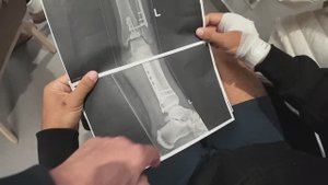 Сыну сделали операцию, депрессивная страна