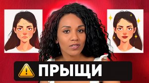 ЧИСТАЯ КОЖА // Что делать с прыщами? Розацеа, акне, периоральный дерматит, акнеподобные высыпания