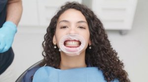 OptraGate 2 - ретракторы| Ivoclar Vivadent (Германия)