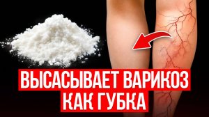 Варикоз не уходит? Вот настоящая ПРИЧИНА, почему лечение не помогает и что делать
