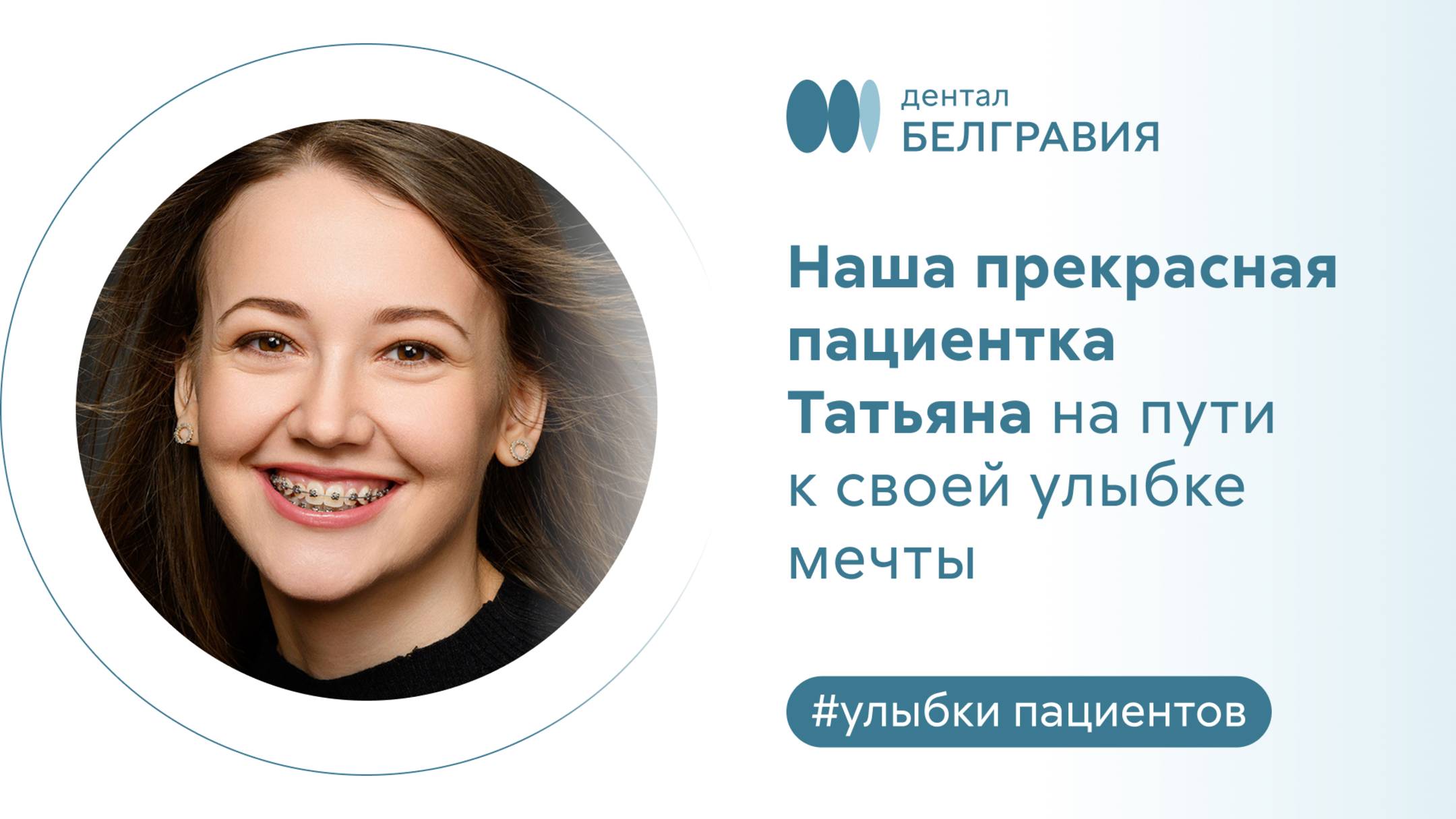 Наша прекрасная пациентка Татьяна на пути к своей улыбке мечты