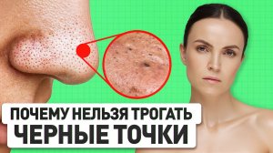 ЭТО ГЛАВНЫЕ ошибки ухода, из-за которых появляются черные точки