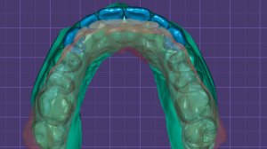 Как загрузить Wax Up в Maestro 3D.