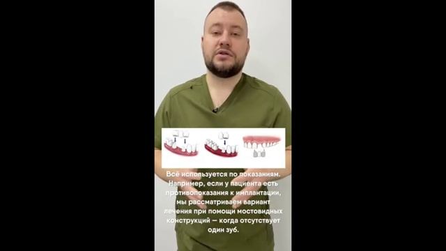 Мостовидный протез - альтернатива импланту смотреть онлайн