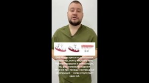 Мостовидный протез - альтернатива импланту