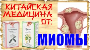 Миома. Препараты ТКМ от миомы.