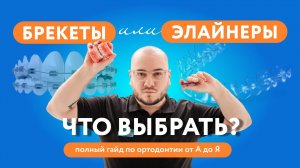 БРЕКЕТЫ или ЭЛАЙНЕРЫ: Что выбрать? Полный гайд по ортодонтии от А до Я ✨