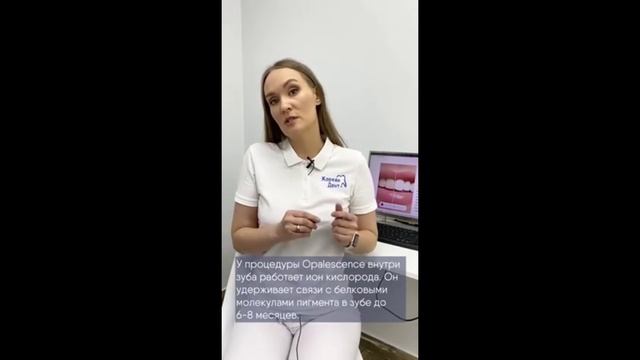 Сколько длится эффект отбеливания? смотреть онлайн