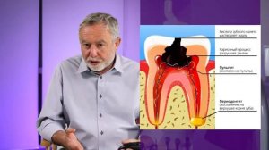 Почему не удаляют нерв при установке виниров или коронок?