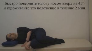 Маневр Казани_Гуфони (Casani_Gufoni) при ДППГ купулолитиазе правого горизонтального канала