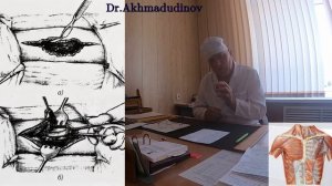 Операции на органах грудной полости. часть 2. Проф. Ахмадудинов М.Г.