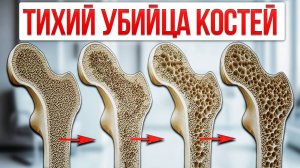 Верни ЗДОРОВЬЕ костей в любом возрасте. Профилактика и УПРАЖНЕНИЯ укрепят ваши кости