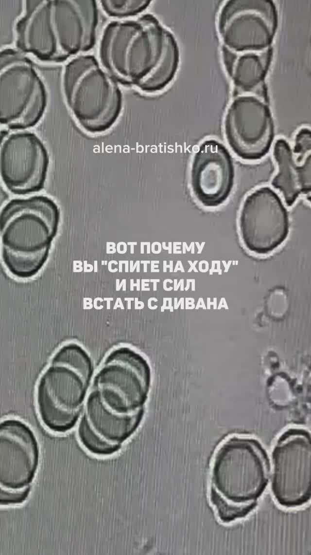 Вот почему вы "спите на ходу" и постоянно нет сил. Семейный доктор Алена Братишко