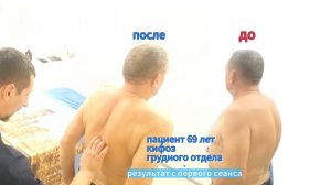 Перестали помогать уколы.