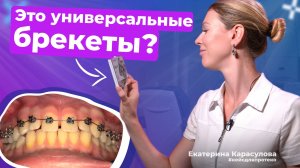 Как исправить щели между зубами быстро и просто