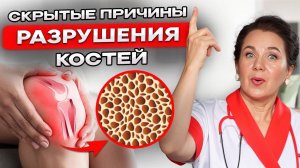 ОСТЕОПОРОЗ: Как не рассыпаться после 45 лет? Причины, симптомы и методы укрепления костей