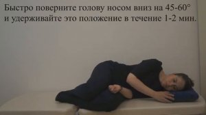 Маневр Аппиани_Гуфони (Appiani_Gufoni) при ДППГ каналолитиазе правого горизонтального  канала