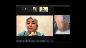 30.10 | Куратор: Дарья Алямовская | Трещины на стопах при грибковых заболеваниях