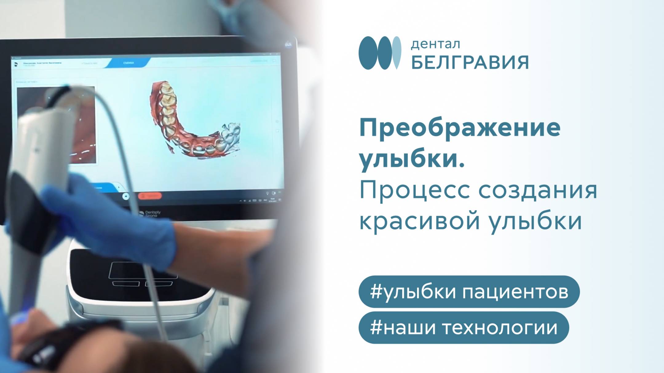 Преображение улыбки. Процесс создания красивой улыбки в Belgravia Dental Studio