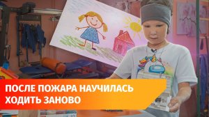 История десятилетней Нурзили из Башкирии. Она получила ожоги, спасая сестер из огня