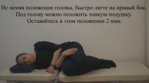 Маневр Аппиани-Гуфони (Appiani-Gufoni) при ДППГ каналолитиазе левого горизонтального канала