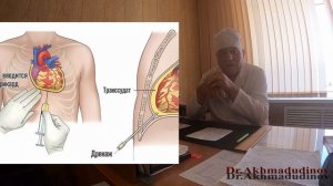 Операции на грудной стенке, органах грудной полости часть1. Проф Ахмадудинов М.Г.