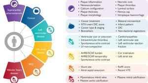 Эмболические инсульты неустановленного происхождения: клиническое консенсусное заявление ESC