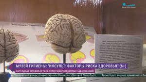 «Инсульт: факторы риска здоровья»: тематическая экспозиция в Музее гигиены