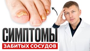 5 признаков, КОТОРЫЕ УКАЖУТ НА ПРОБЛЕМЫ С СЕРДЦЕМ!/ Проверь дома без врача